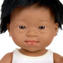 Down Syndrome 15