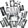 Human X-Rays - Set of 18