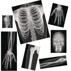 Human X-Rays - Set of 18