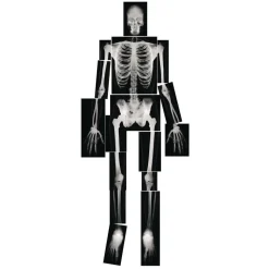 Human X-Rays - Set of 18