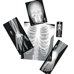 Human X-Rays - Set of 18