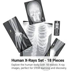 Human X-Rays - Set of 18
